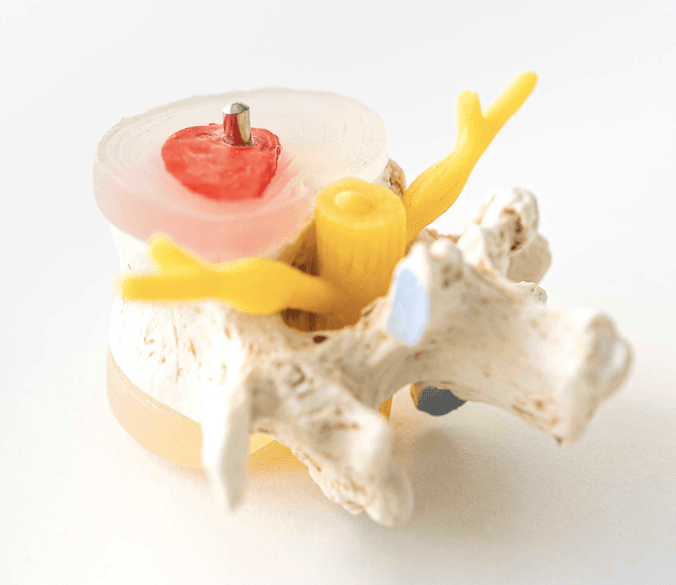 Anatomisches Modell eines Wirbels mit Bandscheibe und Nervenaustritt